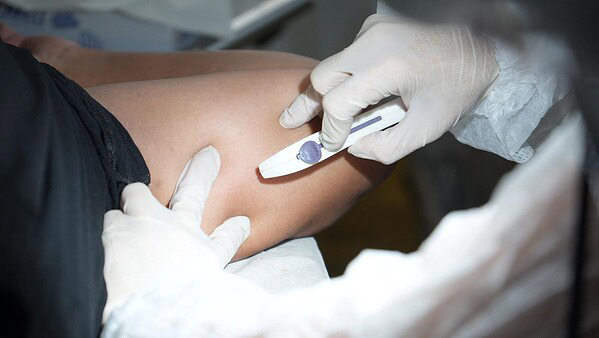 Mais de 50 mulheres recebem implante contraceptivo em ação da Prefeitura de Rio Branco