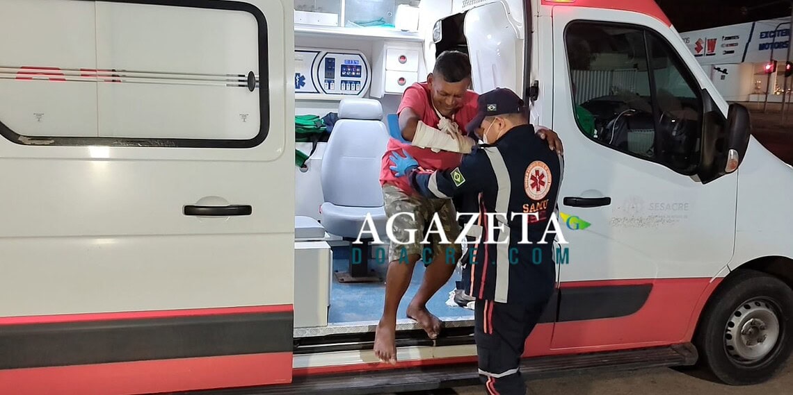 Homem tem braço quebrado após ser agredido com ripa em confraternização em Rio Branco 1 Homem tem braço quebrado após ser agredido com ripa em confraternização em Rio Branco