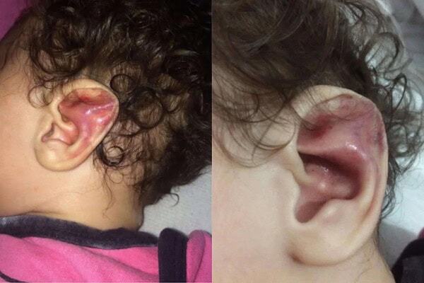 Mãe foragida por torturar e quebrar 6 costelas de filha bebê é presa