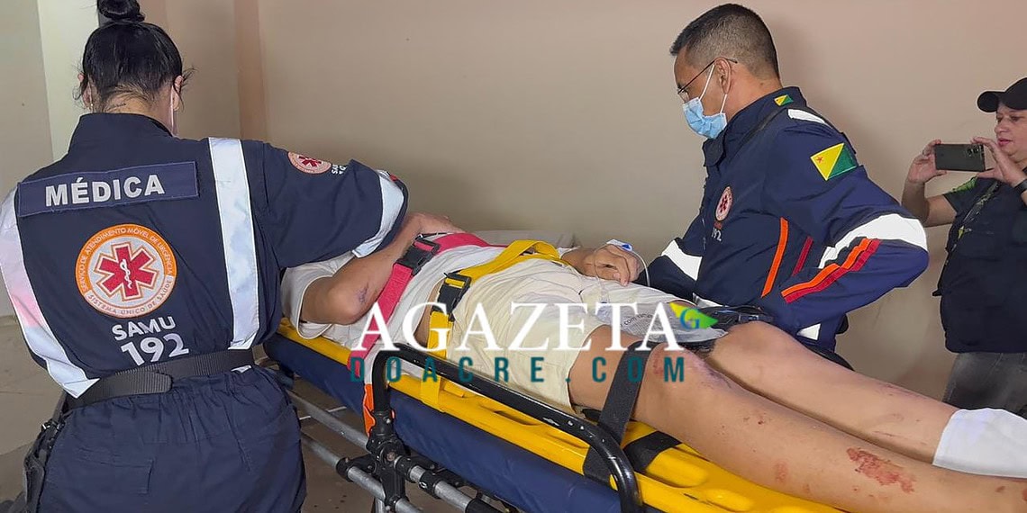 Colisão entre motocicleta e caminhonete deixa adolescente ferido na Baixada da Sobral 1 Colisão entre motocicleta e caminhonete deixa adolescente ferido na Baixada da Sobral