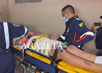Colisão entre motocicleta e caminhonete deixa adolescente ferido na Baixada da Sobral 1 Colisão entre motocicleta e caminhonete deixa adolescente ferido na Baixada da Sobral