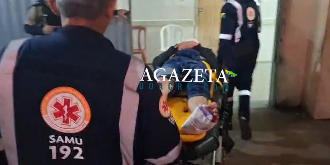 Colisão entre moto e carro deixa jovem com fratura na Rodovia AC-40 em Rio Branco 1 Colisão entre moto e carro deixa jovem com fratura na Rodovia AC-40 em Rio Branco