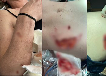 Episódio é considerado pontual e não representa o padrão de comportamento das capivaras, que são animais silvestres, gregários e de hábito herbívoro, segundo especialistas  • Acervo pessoal