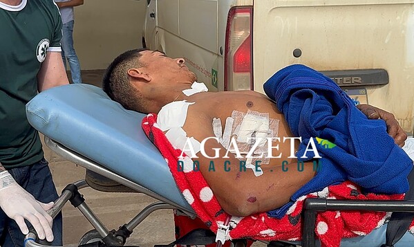 Ataque armado em via pública deixa homem ferido no interior do Acre