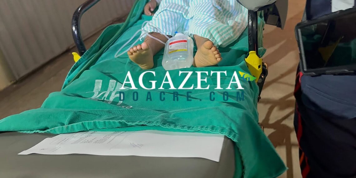 Crianças ficam feridas após acidente com álcool em residência no 2º Distrito