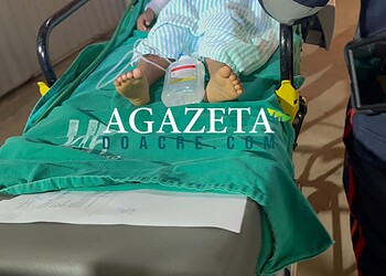 Crianças ficam feridas após acidente com álcool em residência no 2º Distrito 1 Crianças ficam feridas após acidente com álcool em residência no 2º Distrito