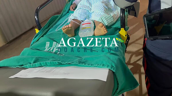 Crianças ficam feridas após acidente com álcool em residência no 2º Distrito