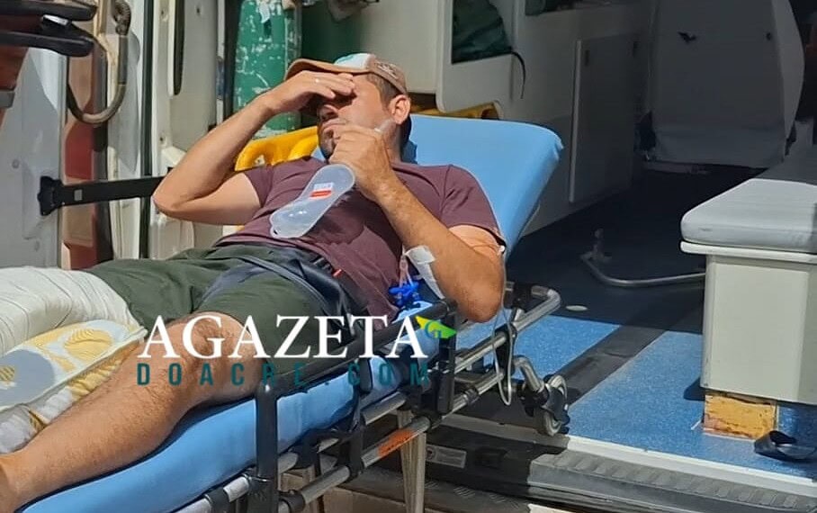 Queda de cavalo deixa homem com fraturas na perna na zona rural de Brasiléia 1 Queda de cavalo deixa homem com fraturas na perna na zona rural de Brasiléia