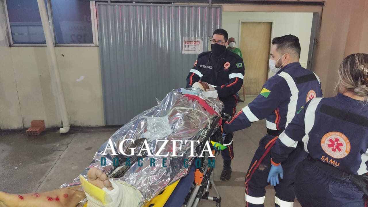 Motociclista de 18 anos fica gravemente ferido após colisão frontal na AC-10, em Rio Branco