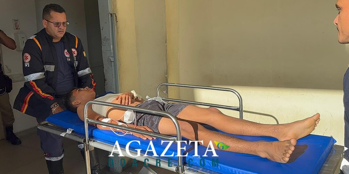 Disparo acidental durante caçada deixa adolescente ferido no interior do Acre