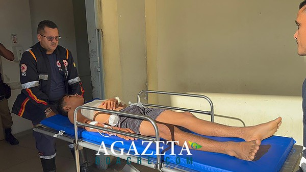 Disparo acidental durante caçada deixa adolescente ferido no interior do Acre