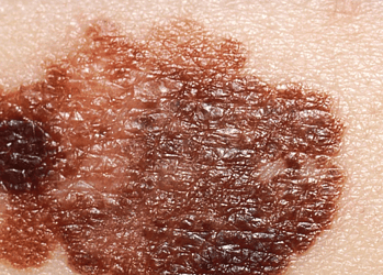 Foto: Callista Images / Getty Images