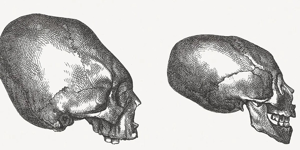 Cientistas acham crânio quadrado que revela antiga técnica mexicana 1 Foto: Getty Images