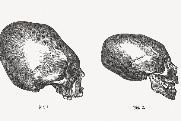 Cientistas acham crânio quadrado que revela antiga técnica mexicana