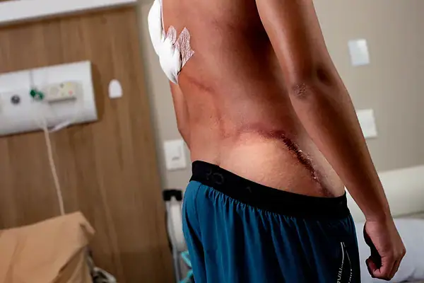 Raio em ato de Nikolas: jovem que teve as costas rasgadas recebe alta