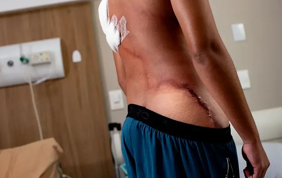 Raio em ato de Nikolas: jovem que teve as costas rasgadas recebe alta 1 Foto: BRENO ESAKI/METRÓPOLES @BrenoEsakiFoto