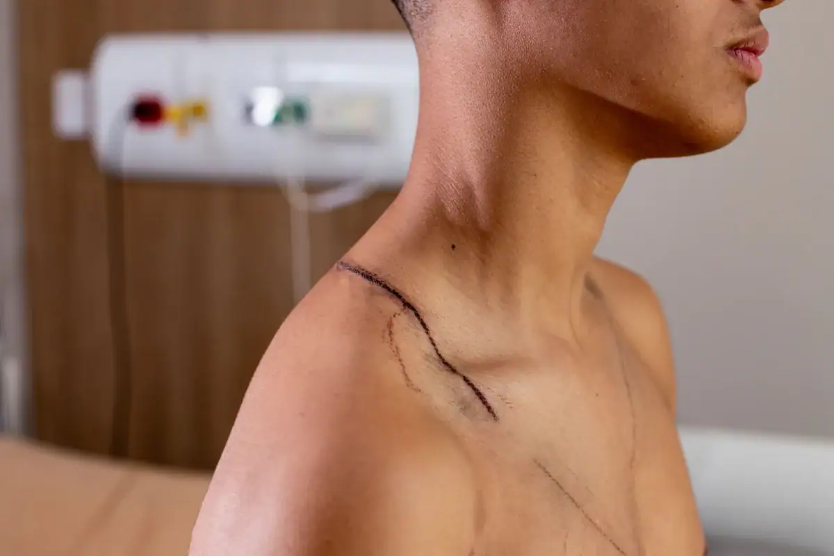 Raio em ato de Nikolas: jovem que teve as costas rasgadas recebe alta 2 Raio em ato de Nikolas: jovem que teve as costas rasgadas recebe alta