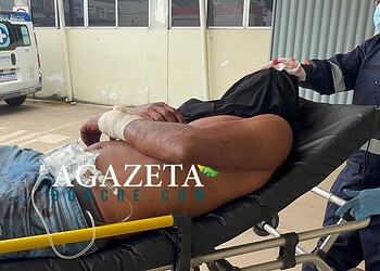 Monitorado por tornozeleira apanha com ripas e terçado no Segundo Distrito