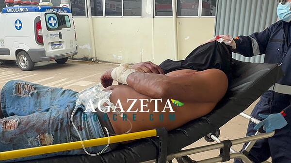 Monitorado por tornozeleira apanha com ripas e terçado no Segundo Distrito