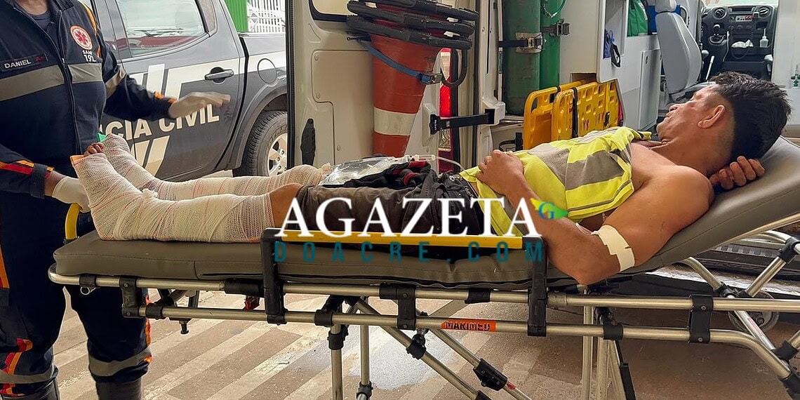 Punição aplicada por facção deixa homem com fraturas nas duas pernas em Rio Branco