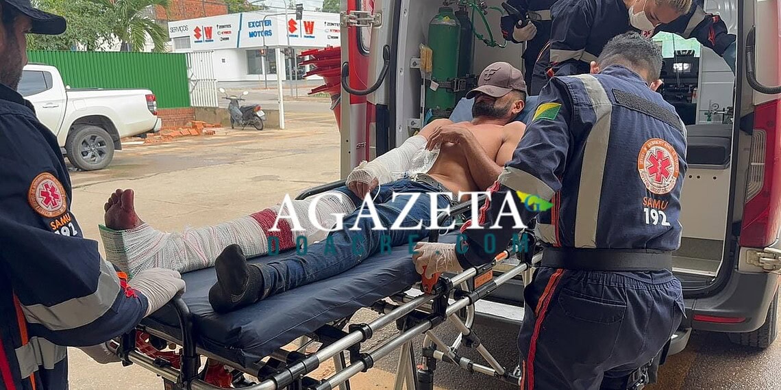 Acidente em ramal da Transacreana deixa motociclista com fratura exposta