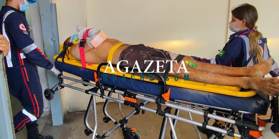 Homem é agredido a golpes de ripa e encontrado ferido no Jardim Primavera, em Rio Branco 1 Homem é agredido a golpes de ripa e encontrado ferido no Jardim Primavera, em Rio Branco