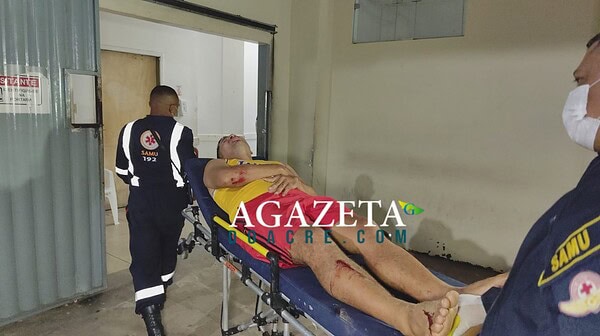 Colisão entre motocicletas em Rio Branco deixa condutor com fratura exposta