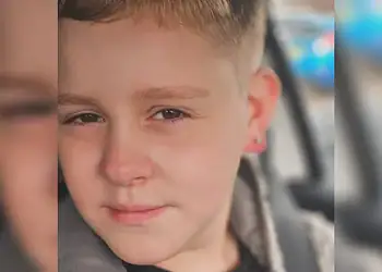 Família não percebe sintomas da meningite e menino de 11 anos tem AVC 1 Reprodução/Instagram/@ms_foxyb_makeup