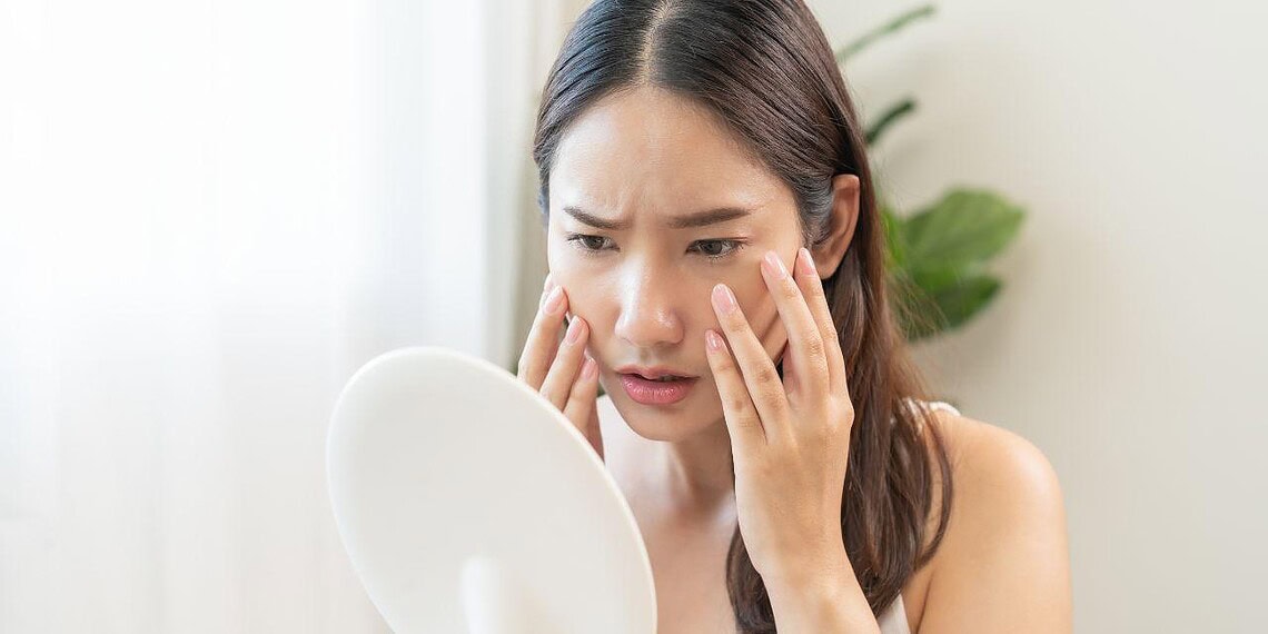 Ressaca cutânea: especialista alerta sobre danos do Carnaval 1 Foto: Shutterstock