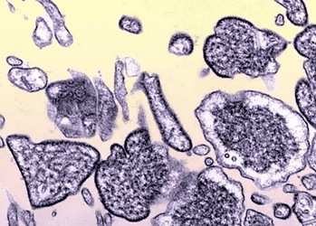 Índia confirma surto do vírus Nipah. Mais de 100 estão em quarentena 2 Foto: BSIP/GettyImages