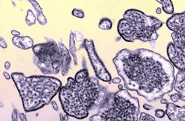 Índia confirma surto do vírus Nipah. Mais de 100 estão em quarentena