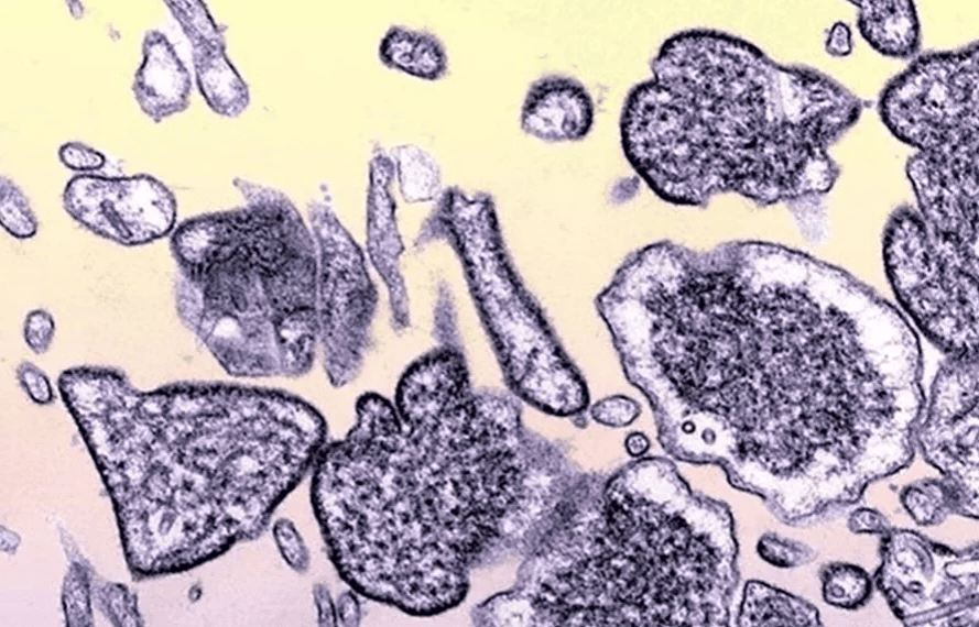 Foto: BSIP/GettyImages