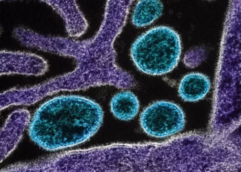 Nipah: entenda o que é o vírus com alto índice de mortalidade que causa novo surto na Índia 2 Foto: NIAID/Wikimedia Commons