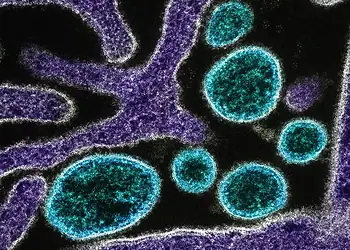 Foto: National Institute of Allergy and Infectious Diseases/Unsplash