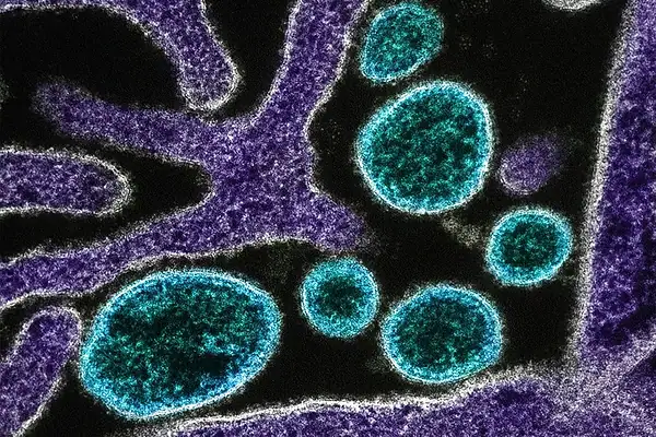 OMS considera baixo risco de disseminação do vírus Nipah além da Índia