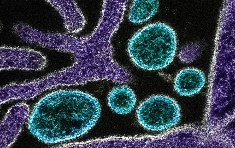 Foto: National Institute of Allergy and Infectious Diseases/Unsplash