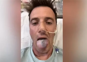 Um tumor foi descoberto na base da língua de Anthony — Foto: Anthony Perriam