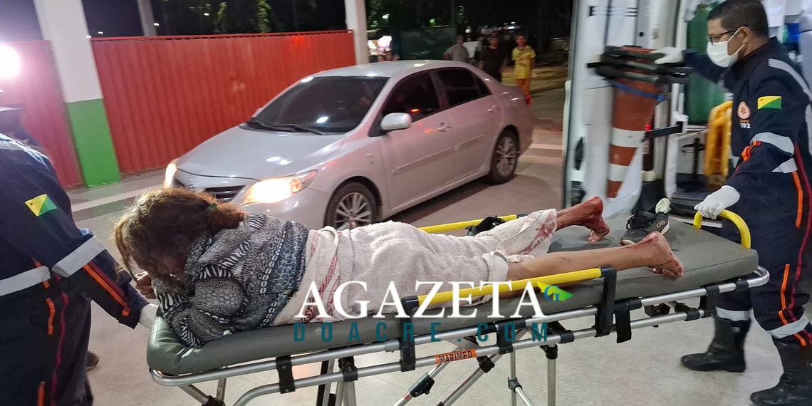 Homem esfaqueia namorada após discussão motivada por ciúmes 1 O golpe foi desferido nas nadegas da mulher. Foto: A Gazeta do Acre