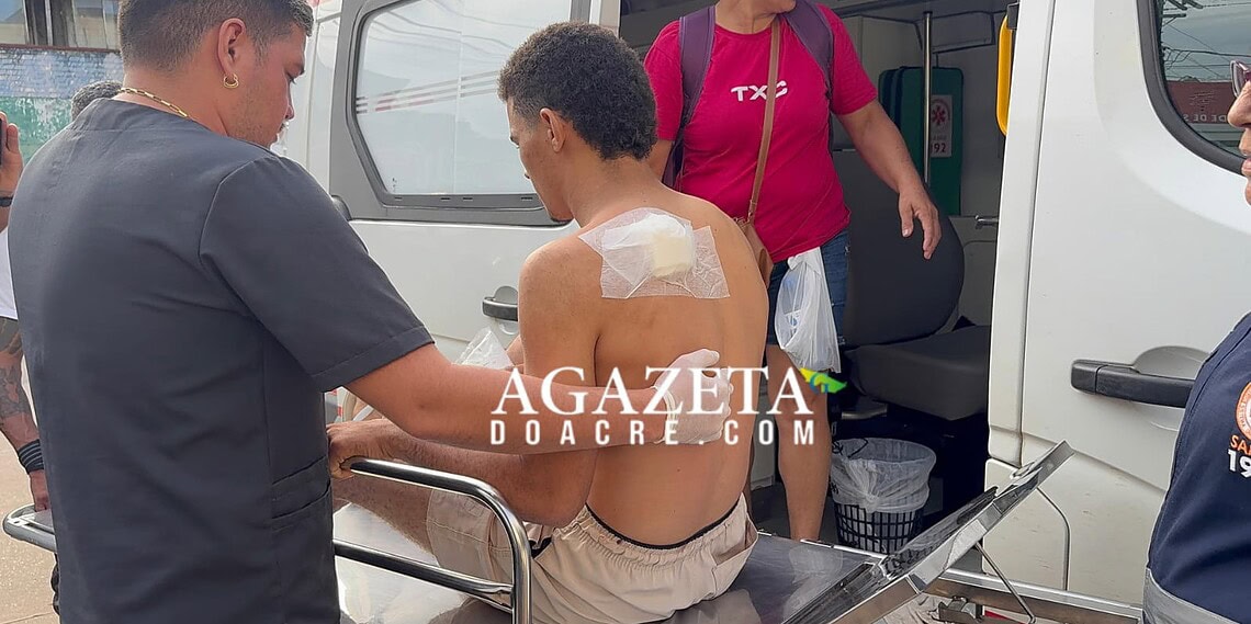 Jovem é baleado nas costas após amigo confundir movimento na mata com animal durante caçada no Acre