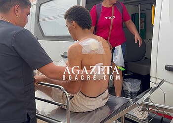 Jovem é baleado nas costas após amigo confundir movimento na mata com animal durante caçada no Acre