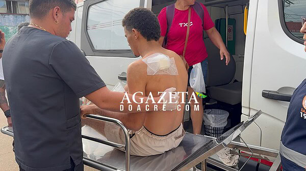 Jovem é baleado nas costas após amigo confundir movimento na mata com animal durante caçada no Acre