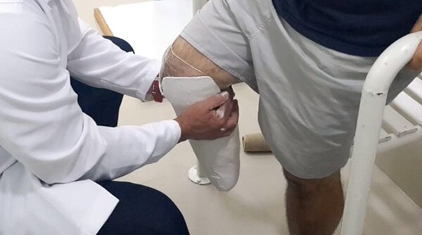 Rio Branco aprova política de prevenção a amputações em pacientes com diabetes