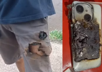 Mecânico é atacado por cachorros, animal morde celular e aparelho explode no bolso do homem 3 Mecânico é atacado por cachorros, animal morde celular e aparelho explode no bolso. — Foto: Cristiane Guimarães/RPC