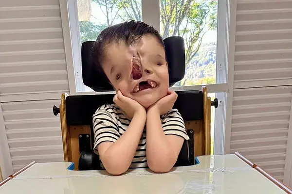 Família faz vaquinha para tratamento de menino com condição médica rara