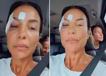 Ivete Sangalo deixa hospital após diagnóstico; saiba o que aconteceu 2 Foto: Reprodução/Instagram
