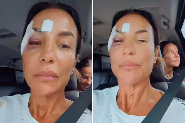 Ivete Sangalo deixa hospital após diagnóstico; saiba o que aconteceu