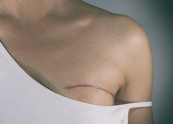 Foto: Reprodução/Internet/Ilustrativa