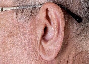 Sinal de Frank pode ser indício de problema cardíaco? - (crédito: Reprodução/Google)