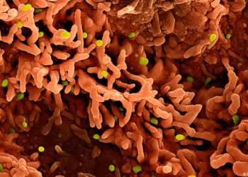 Os três vírus que podem desencadear novas crises em 2026 3 Partículas do vírus mpox (em verde) sobre células infectadas. Disseminação do patógeno ainda preocupa especialistas. — Foto: NIH-NIAID/IMAGE POINT FR/BSIP/picture alliance