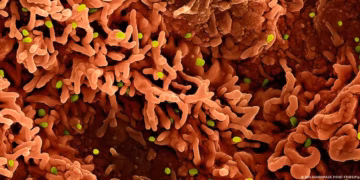 Partículas do vírus mpox (em verde) sobre células infectadas. Disseminação do patógeno ainda preocupa especialistas. — Foto: NIH-NIAID/IMAGE POINT FR/BSIP/picture alliance